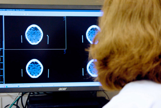Eine Frau guckt sich CT Bilder eines Gehirns an