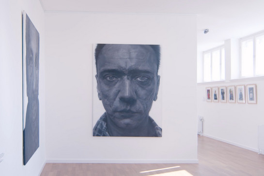 Schwarz-weiß-Portrait von einem Mann mit einem stark vernarbten Gesicht und leidvollem Gesichtsausdruck hängt an der Wand des Museums.