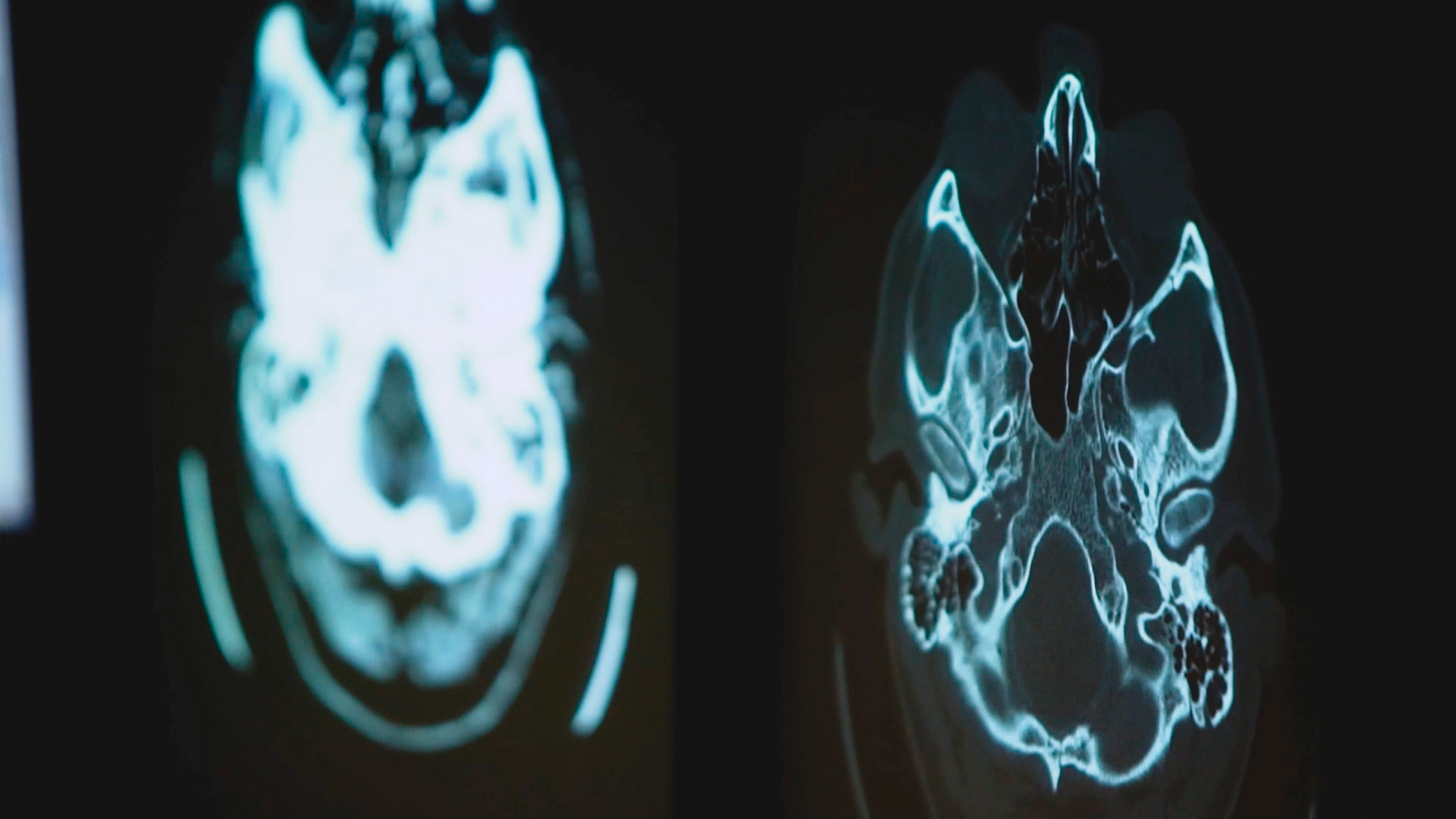 CT Bilder eines Gehirns